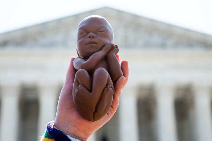 Wisconsin Supreme Court strikes down 19th-century abortion ban; other restrictions kept in place